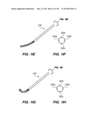 ANTI-BUCKLING MECHANISMS AND METHODS diagram and image