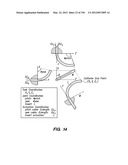 ANTI-BUCKLING MECHANISMS AND METHODS diagram and image