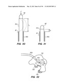 ANTI-BUCKLING MECHANISMS AND METHODS diagram and image