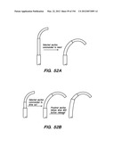 ANTI-BUCKLING MECHANISMS AND METHODS diagram and image