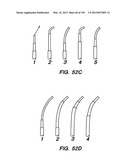 ANTI-BUCKLING MECHANISMS AND METHODS diagram and image