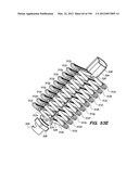 ANTI-BUCKLING MECHANISMS AND METHODS diagram and image