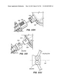 ANTI-BUCKLING MECHANISMS AND METHODS diagram and image