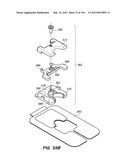 ANTI-BUCKLING MECHANISMS AND METHODS diagram and image