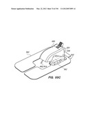 ANTI-BUCKLING MECHANISMS AND METHODS diagram and image