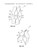 ANTI-BUCKLING MECHANISMS AND METHODS diagram and image