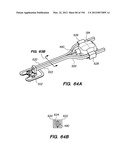 ANTI-BUCKLING MECHANISMS AND METHODS diagram and image