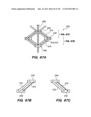 ANTI-BUCKLING MECHANISMS AND METHODS diagram and image