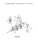 ANTI-BUCKLING MECHANISMS AND METHODS diagram and image