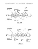 ANTI-BUCKLING MECHANISMS AND METHODS diagram and image