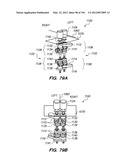 ANTI-BUCKLING MECHANISMS AND METHODS diagram and image