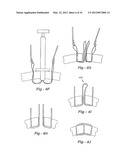 SOFT TISSUE REPAIR METHODS AND APPARATUS diagram and image