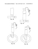 SOFT TISSUE REPAIR METHODS AND APPARATUS diagram and image