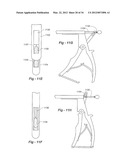 SOFT TISSUE REPAIR METHODS AND APPARATUS diagram and image