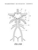 PLAQUE REMOVAL DEVICE WITH ROTATABLE CUTTING ELEMENT diagram and image