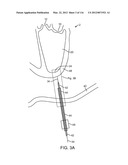 SYSTEM FOR PROVIDING SURGICAL ACCESS diagram and image