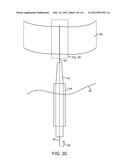 SYSTEM FOR PROVIDING SURGICAL ACCESS diagram and image