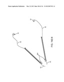 SYSTEM FOR PROVIDING SURGICAL ACCESS diagram and image