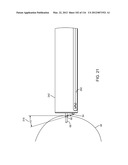 SYSTEM FOR PROVIDING SURGICAL ACCESS diagram and image