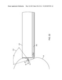 SYSTEM FOR PROVIDING SURGICAL ACCESS diagram and image