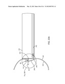 SYSTEM FOR PROVIDING SURGICAL ACCESS diagram and image