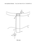 SYSTEM FOR PROVIDING SURGICAL ACCESS diagram and image