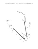 SYSTEM FOR PROVIDING SURGICAL ACCESS diagram and image