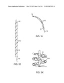 SYSTEM FOR PROVIDING SURGICAL ACCESS diagram and image