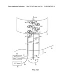 SYSTEM FOR PROVIDING SURGICAL ACCESS diagram and image