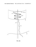 SYSTEM FOR PROVIDING SURGICAL ACCESS diagram and image