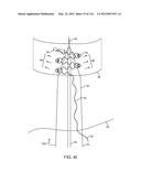 SYSTEM FOR PROVIDING SURGICAL ACCESS diagram and image