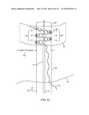 SYSTEM FOR PROVIDING SURGICAL ACCESS diagram and image