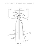 SYSTEM FOR PROVIDING SURGICAL ACCESS diagram and image