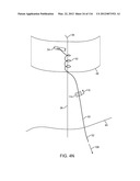 SYSTEM FOR PROVIDING SURGICAL ACCESS diagram and image