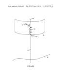 SYSTEM FOR PROVIDING SURGICAL ACCESS diagram and image