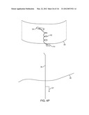 SYSTEM FOR PROVIDING SURGICAL ACCESS diagram and image