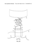 SYSTEM FOR PROVIDING SURGICAL ACCESS diagram and image