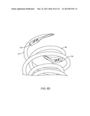 SYSTEM FOR PROVIDING SURGICAL ACCESS diagram and image