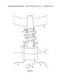 SYSTEM FOR PROVIDING SURGICAL ACCESS diagram and image