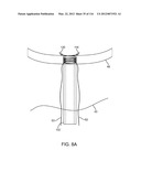 SYSTEM FOR PROVIDING SURGICAL ACCESS diagram and image