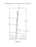 SYSTEM FOR PROVIDING SURGICAL ACCESS diagram and image