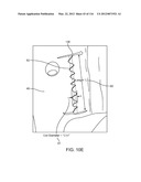 SYSTEM FOR PROVIDING SURGICAL ACCESS diagram and image