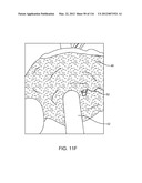 SYSTEM FOR PROVIDING SURGICAL ACCESS diagram and image