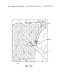 SYSTEM FOR PROVIDING SURGICAL ACCESS diagram and image