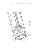 SYSTEM FOR PROVIDING SURGICAL ACCESS diagram and image