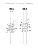 SPINAL COLUMN STABILIZATION SYSTEM, CONNECTING ELEMENT FOR A SPINAL COLUMN     STABILIZATION SYSTEM AND METHOD OF MANUFACTURING SUCH A CONNECTING     ELEMENT diagram and image