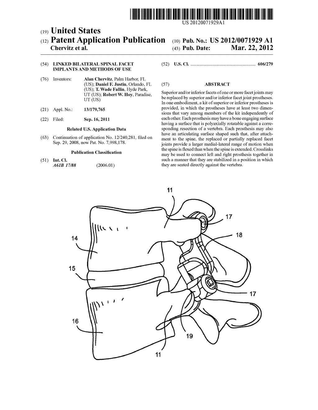 Linked Bilateral Spinal Facet Implants and Methods of Use - diagram, schematic, and image 01