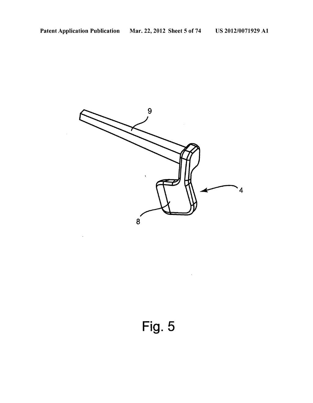 Linked Bilateral Spinal Facet Implants and Methods of Use - diagram, schematic, and image 06