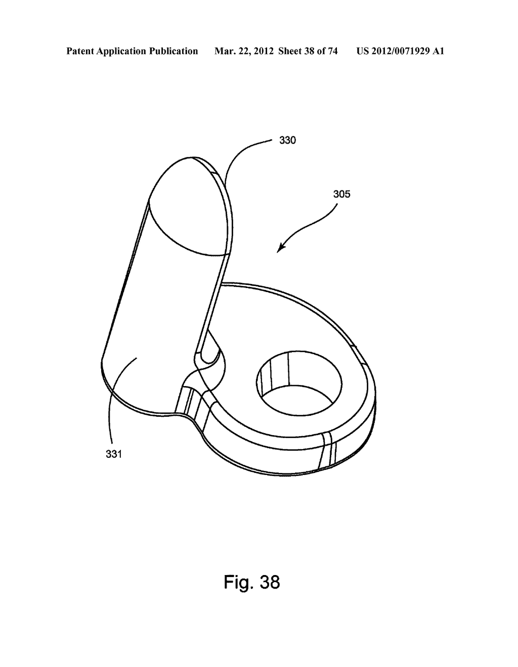 Linked Bilateral Spinal Facet Implants and Methods of Use - diagram, schematic, and image 39