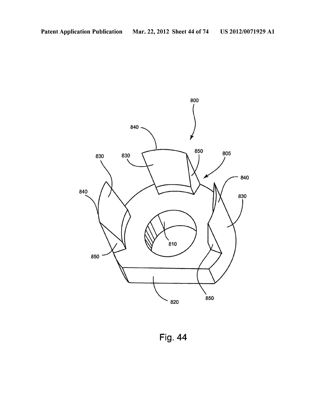 Linked Bilateral Spinal Facet Implants and Methods of Use - diagram, schematic, and image 45